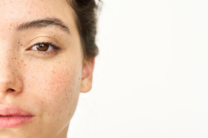 Icoone face & neck sculpting
