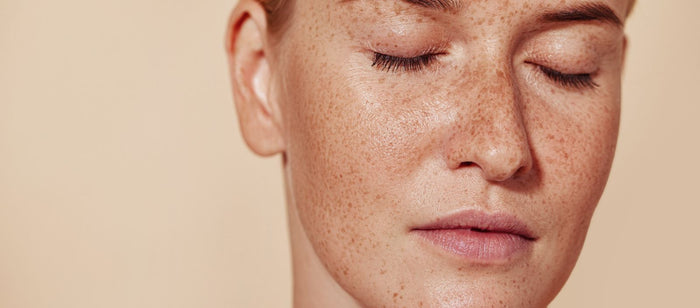 Skin Ceuticals anti pigmentation peel