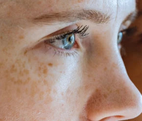 Mela 02 lightening– Dé behandeling tegen pigmentvlekken, melasma en post-acnevlekken