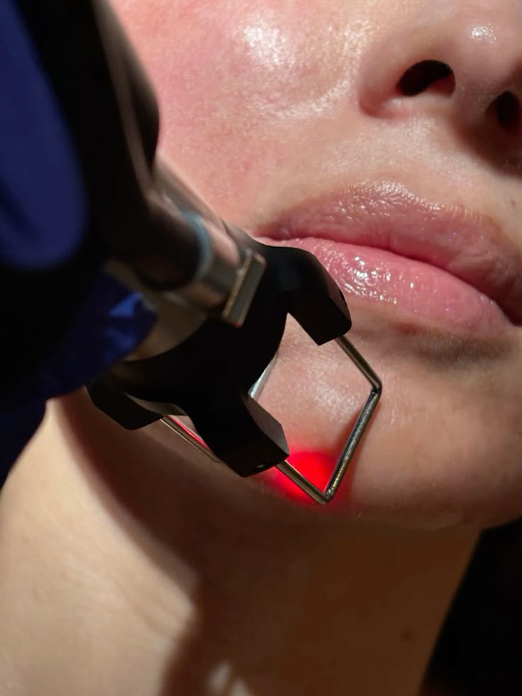 Waarom iedereen het over CoolPeel heeft