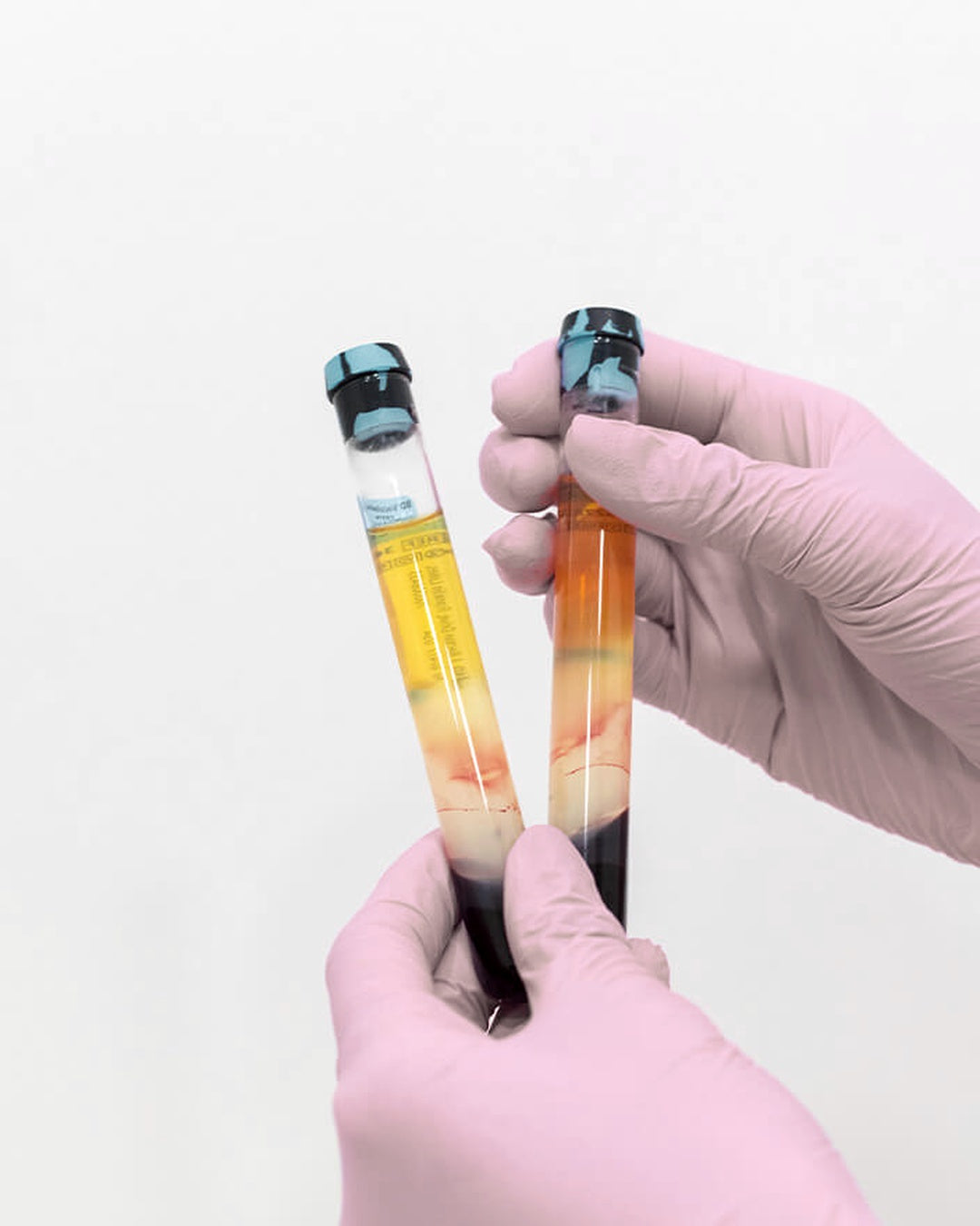 PRP behandeling - Vampire Facial